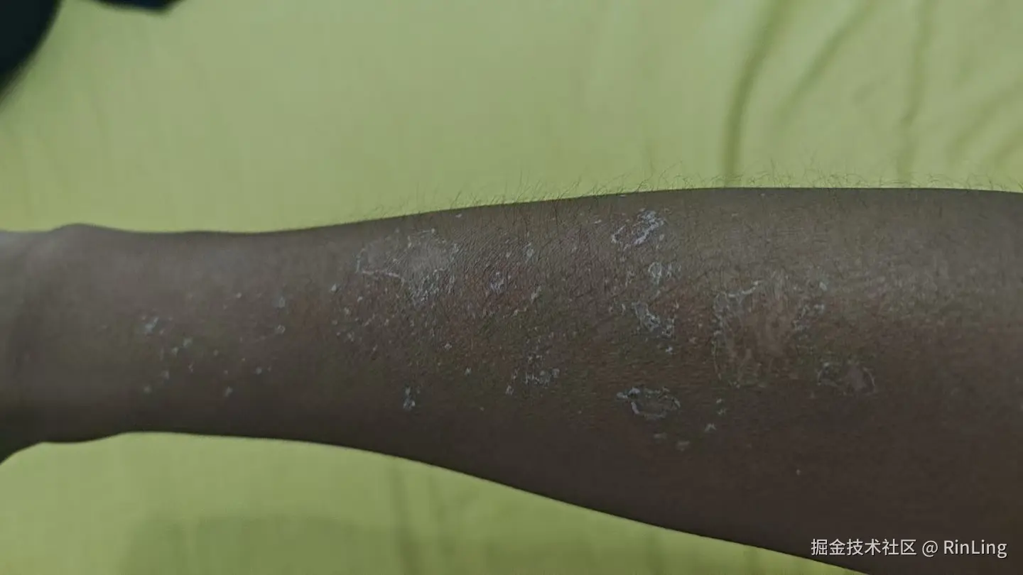 RinLing于2025-08-25 18:14发布的图片