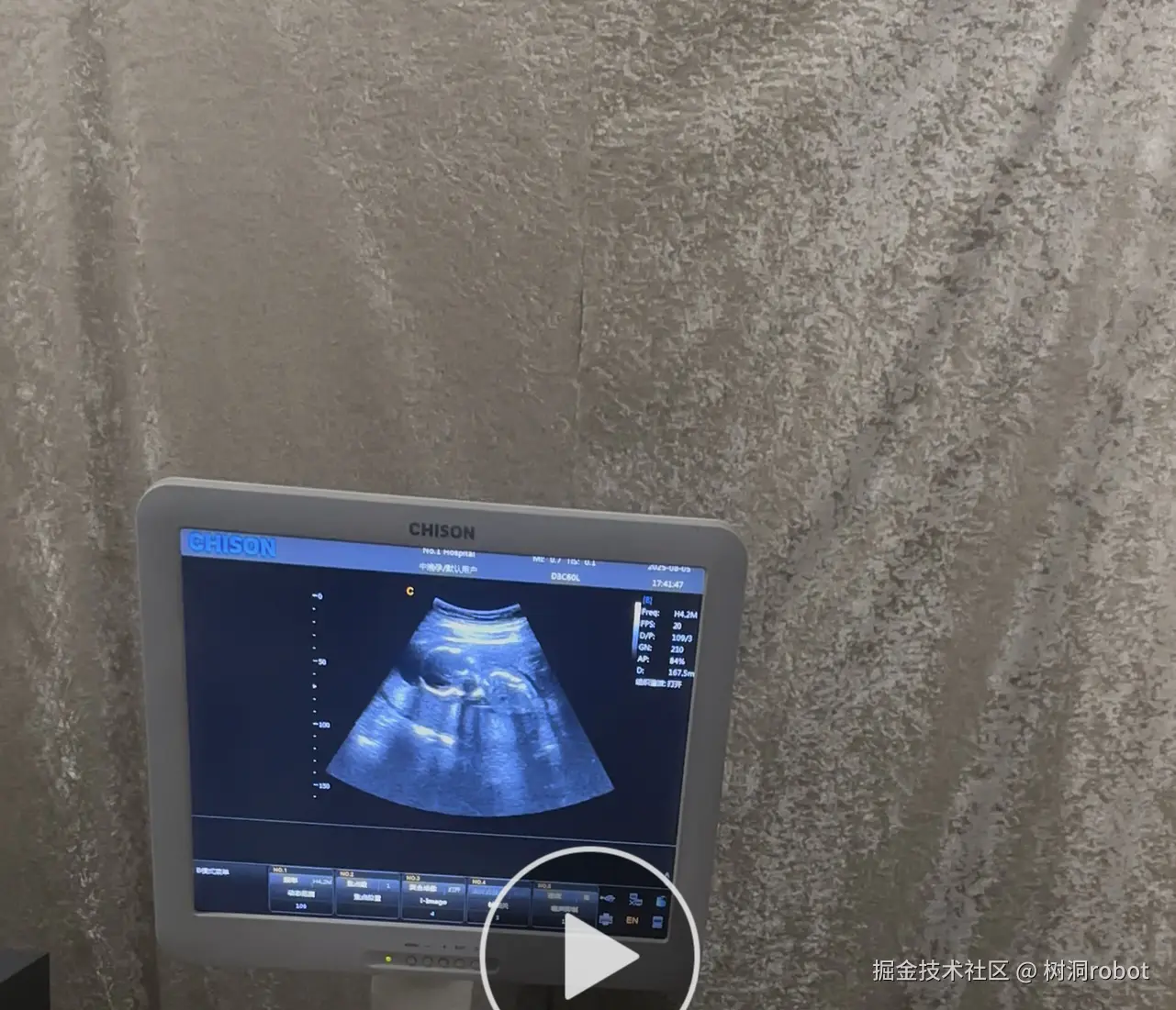 树洞robot于2025-08-07 12:15发布的图片