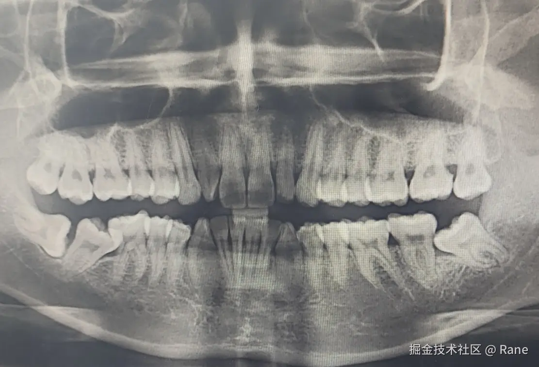Rane于2026-01-04 10:05发布的图片