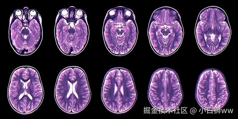 小白狮ww于2025-10-28 18:20发布的图片