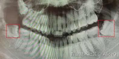 AliceQ于2024-09-18 09:52发布的图片