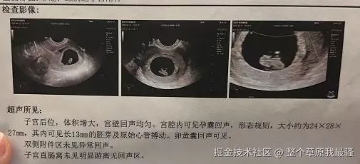 整个草原我最骚于2025-04-14 15:38发布的图片