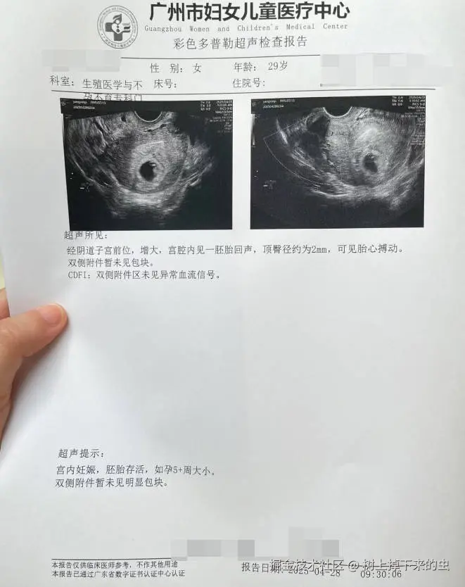 树上掉下来的虫于2025-04-28 10:14发布的图片