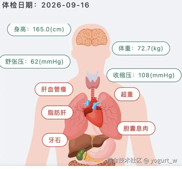 yogurt_w于2026-09-20 02:12发布的图片