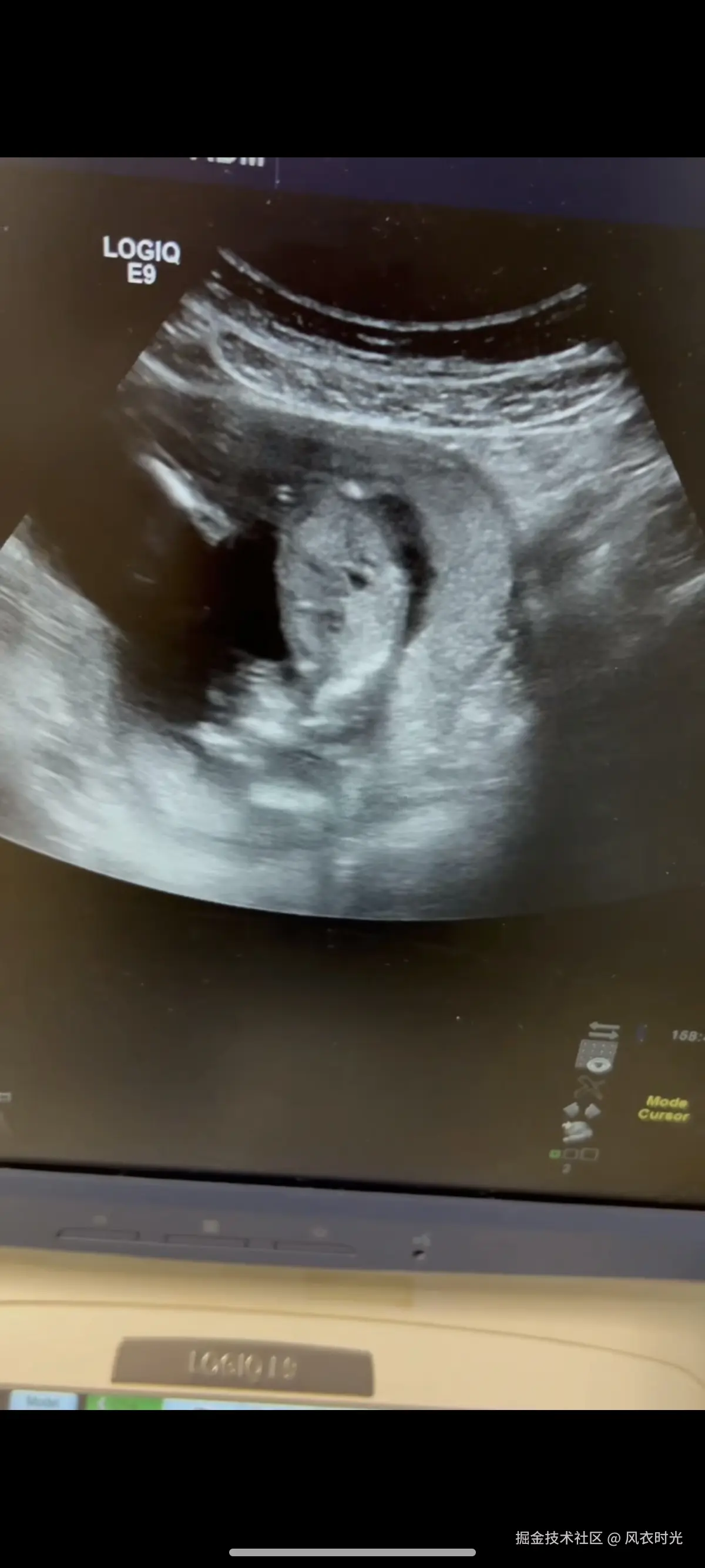 风衣时光于2026-01-28 15:31发布的图片