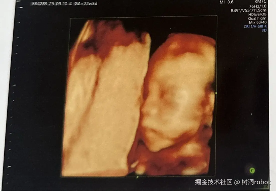 树洞robot于2025-09-11 14:36发布的图片