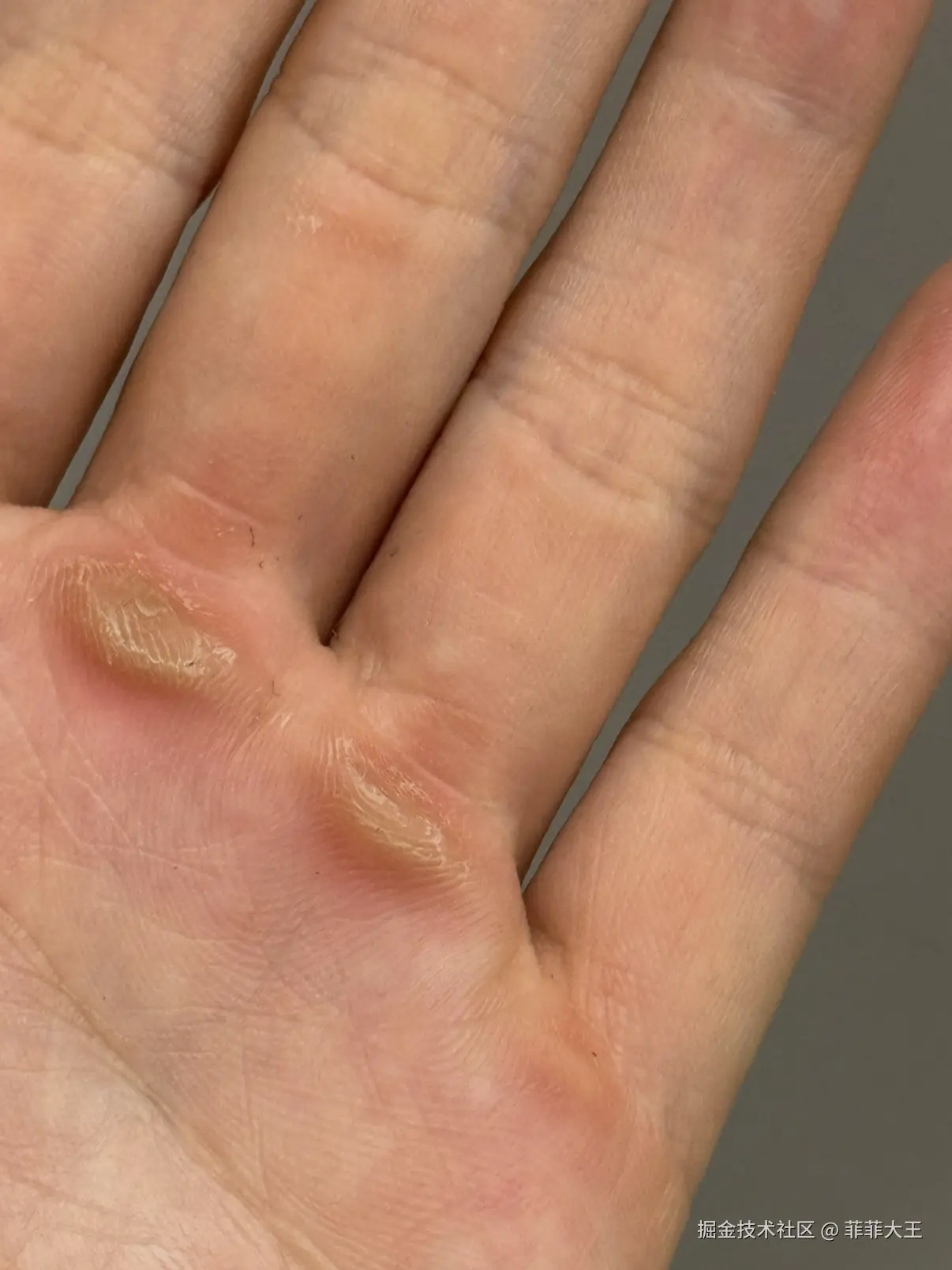 菲菲大王于2026-04-01 15:45发布的图片