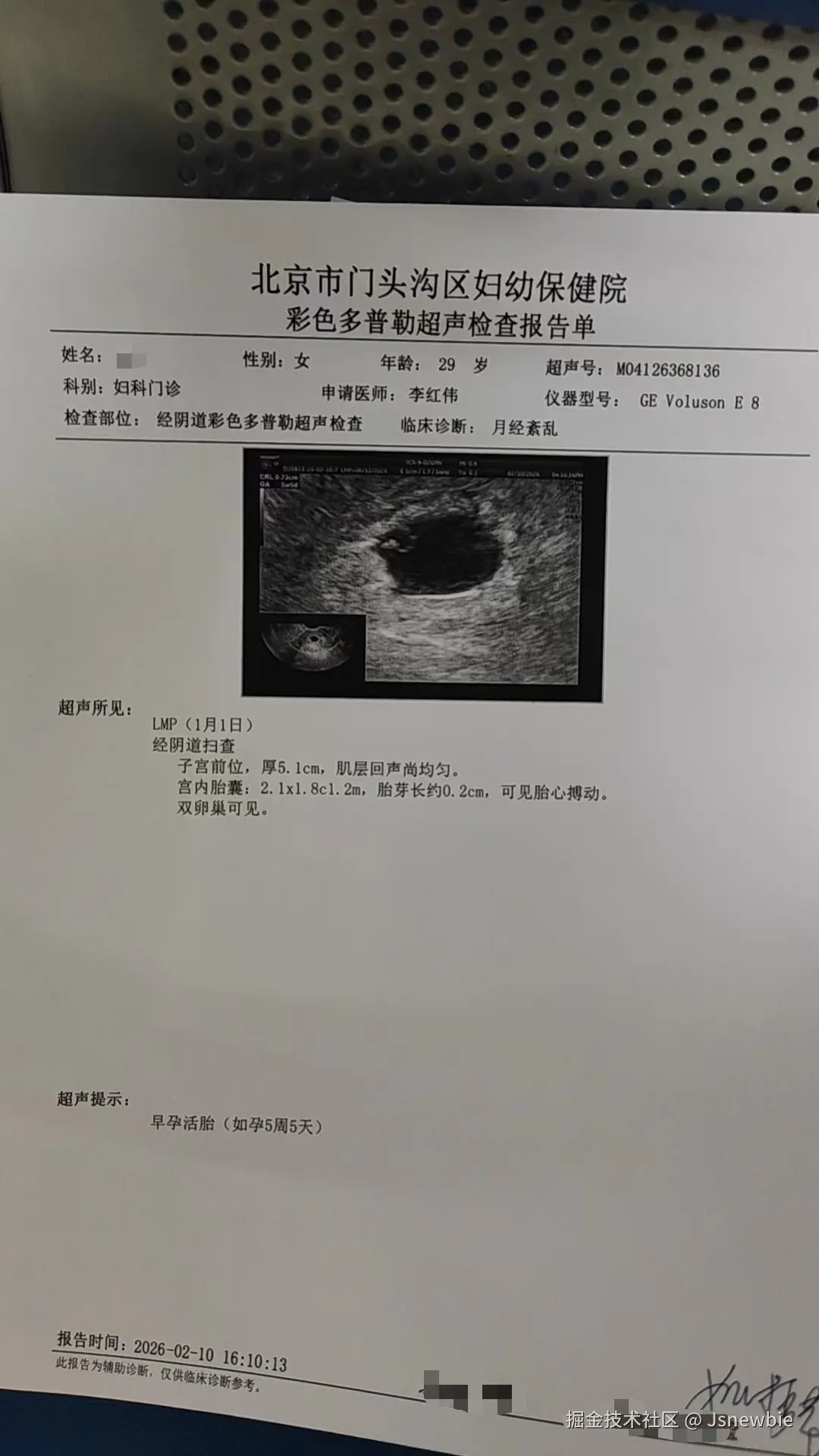 Jsnewbie于2026-02-10 16:31发布的图片